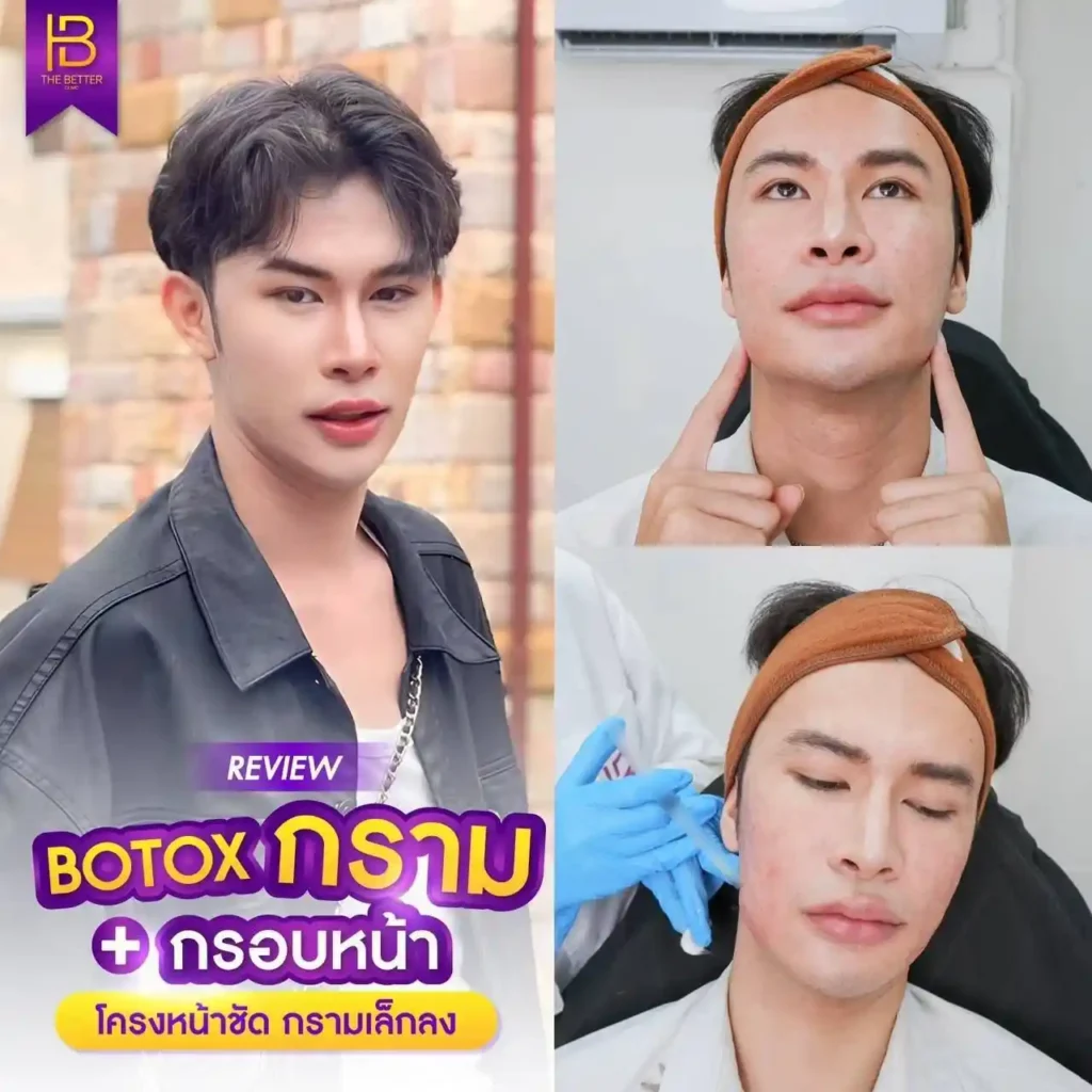 รูปรีวิว 279
