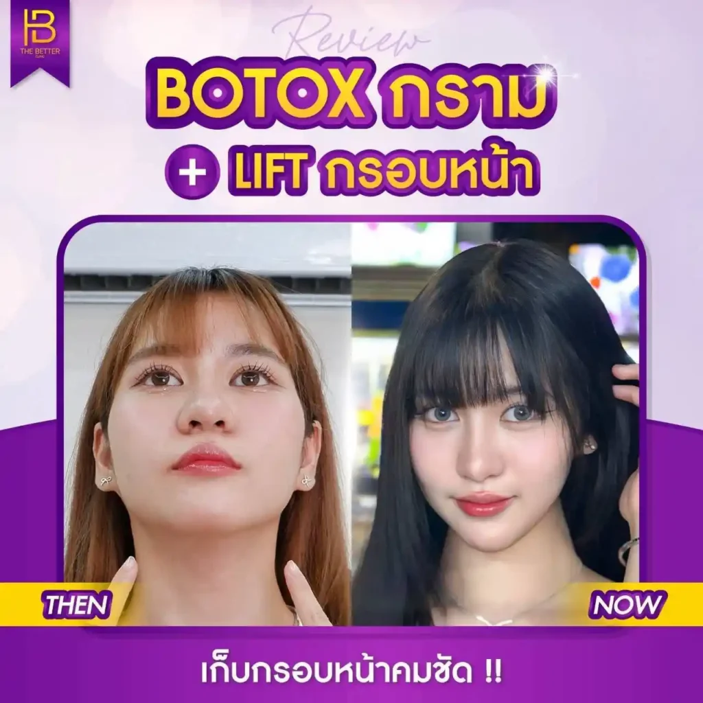 รูปรีวิว 280