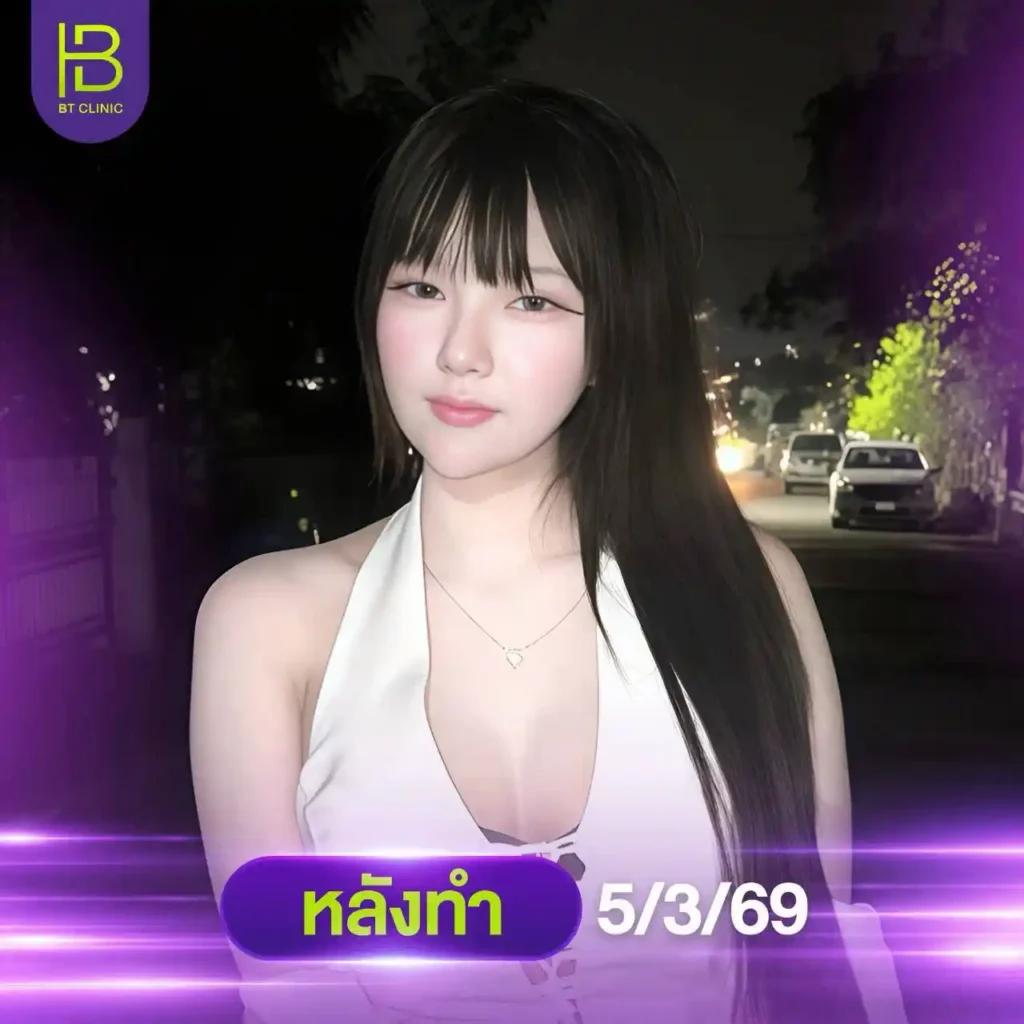 รูปรีวิว 281