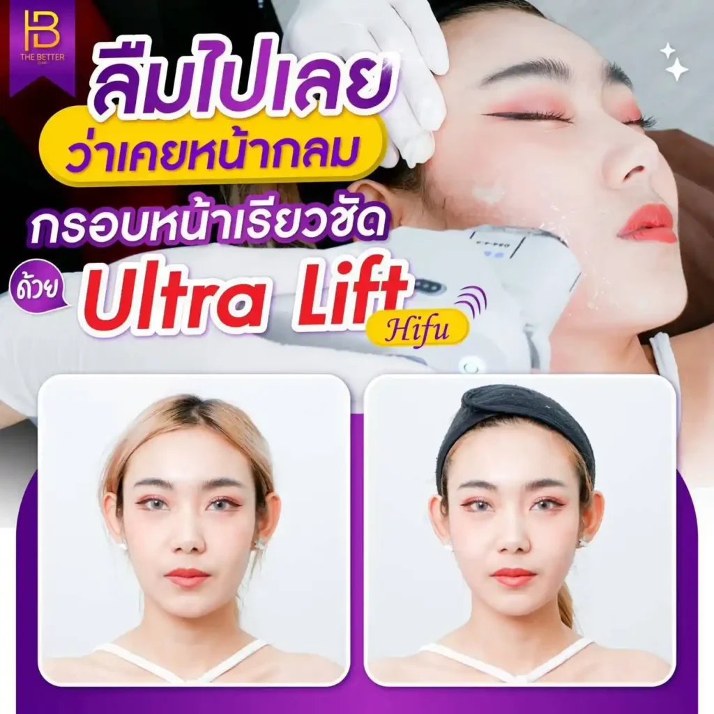 รูปรีวิว 292
