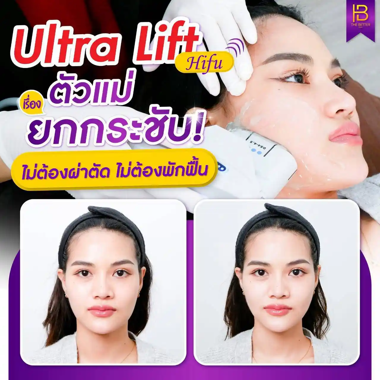 รูปรีวิว 294