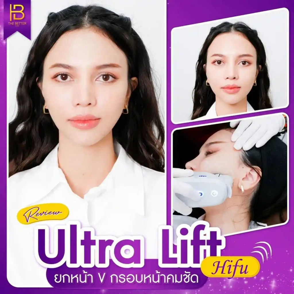 รูปรีวิว 296