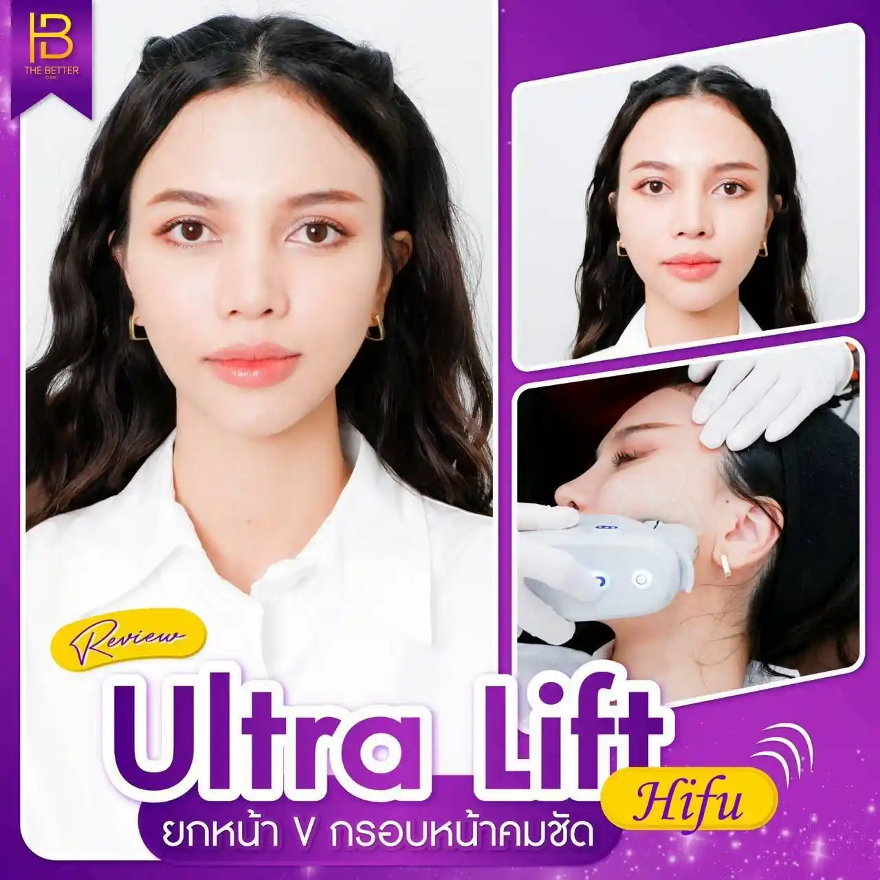 รูปรีวิว 296