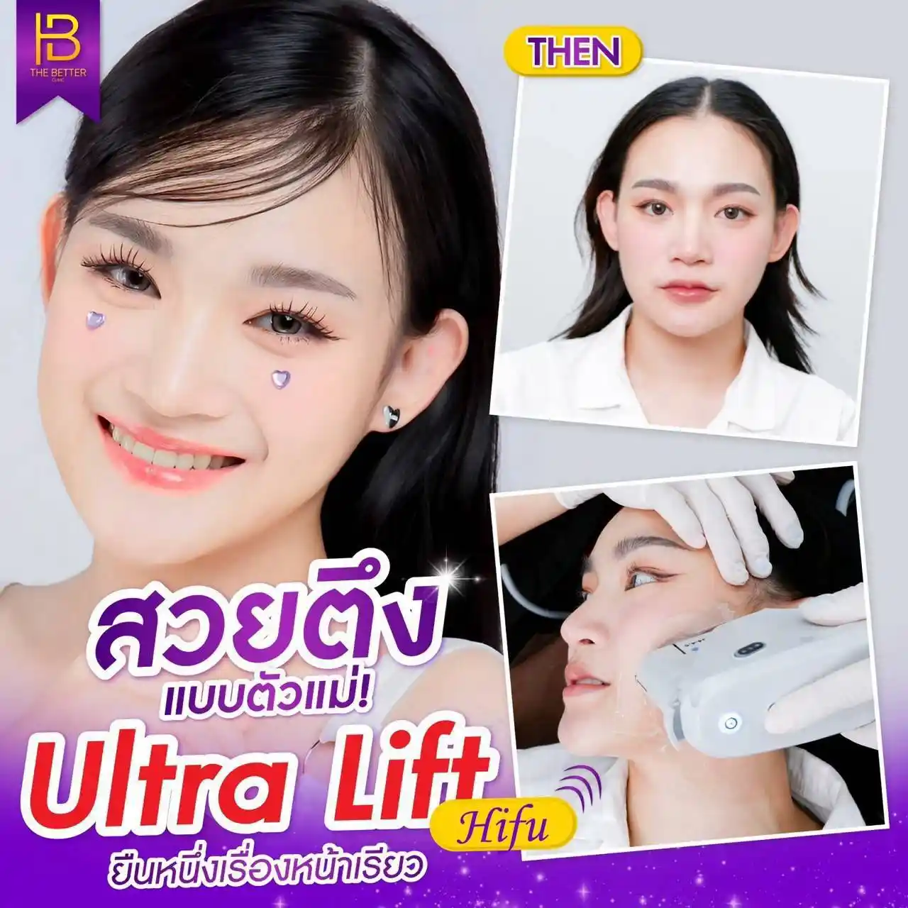รูปรีวิว 297