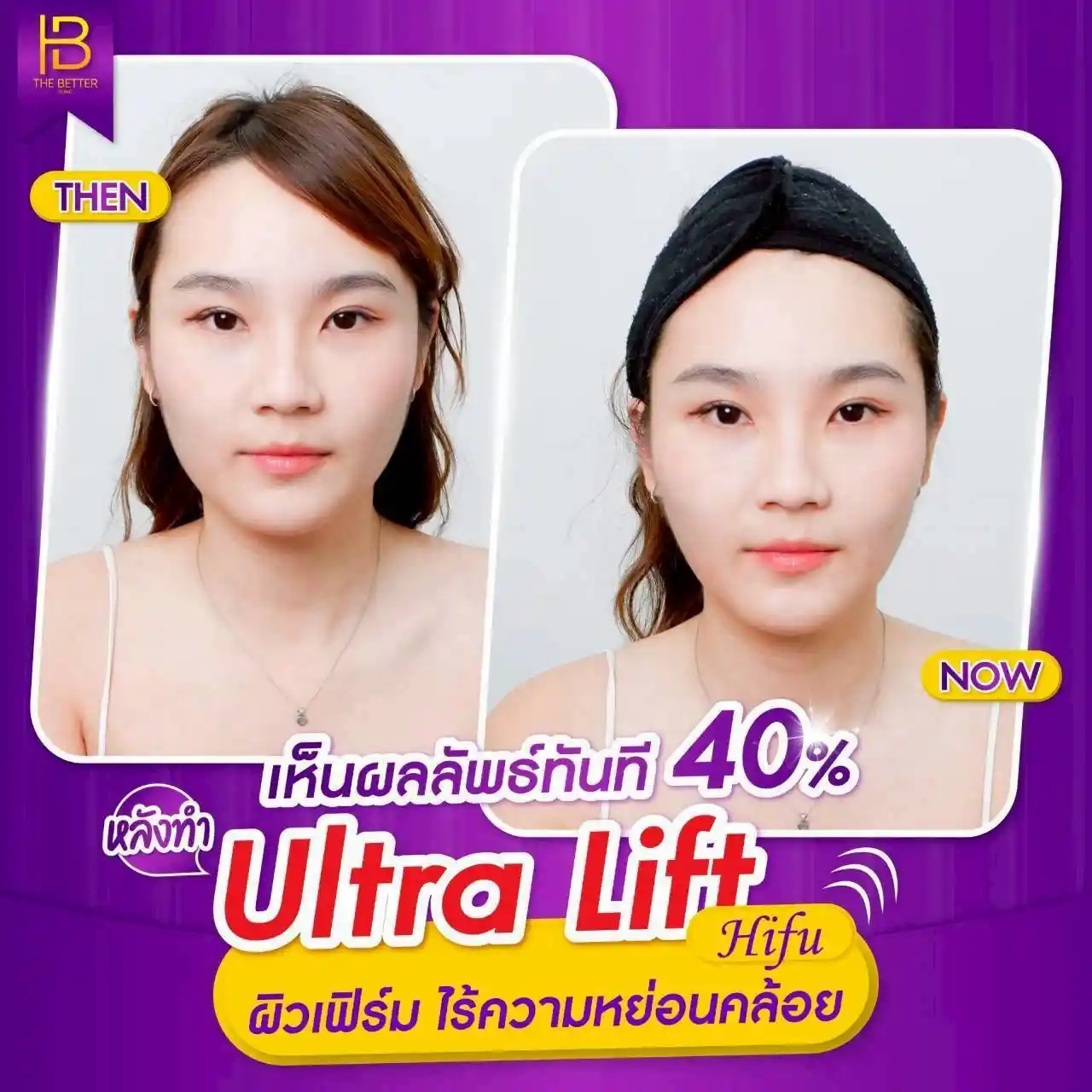 รูปรีวิว 300