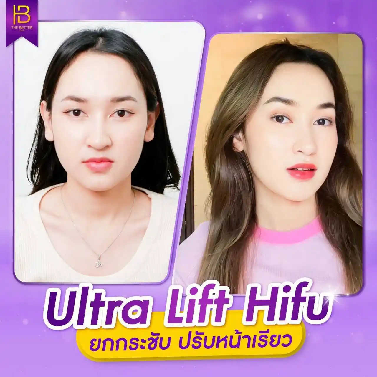 รูปรีวิว 301