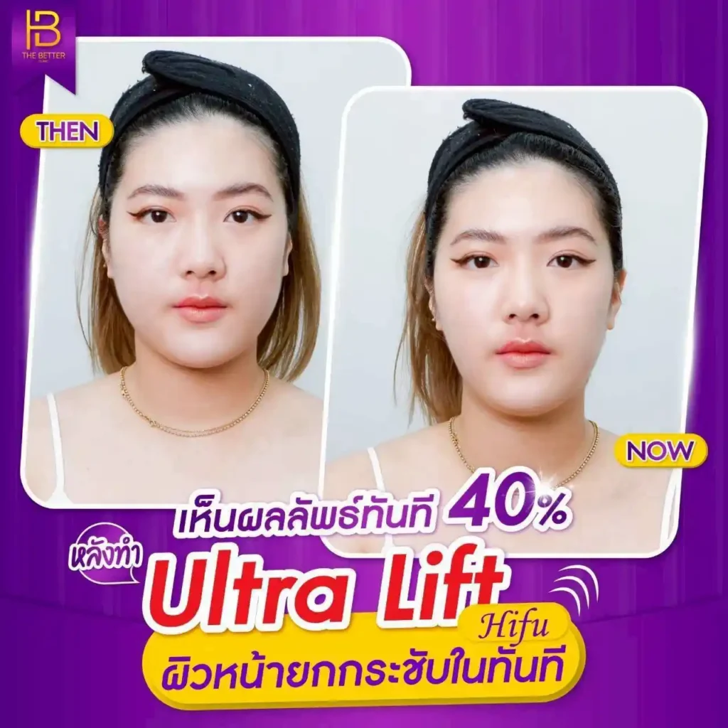 รูปรีวิว 303