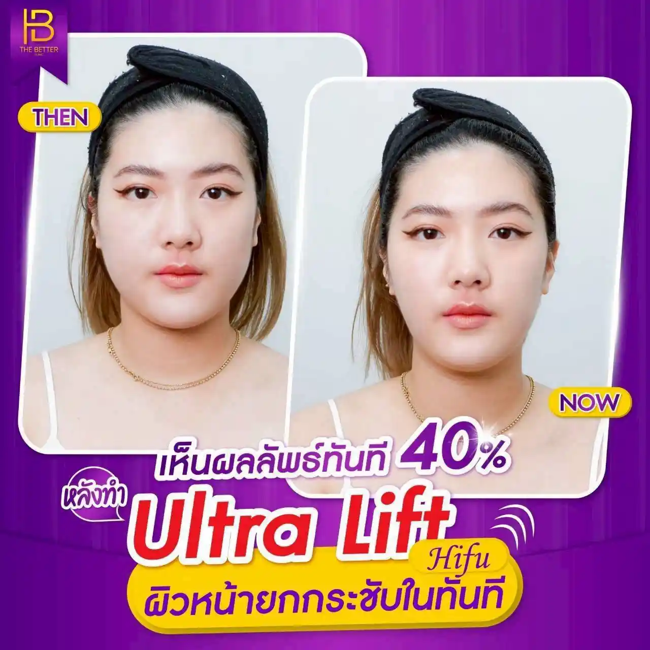 รูปรีวิว 303