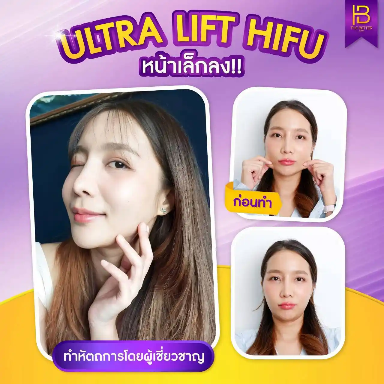 รูปรีวิว 304