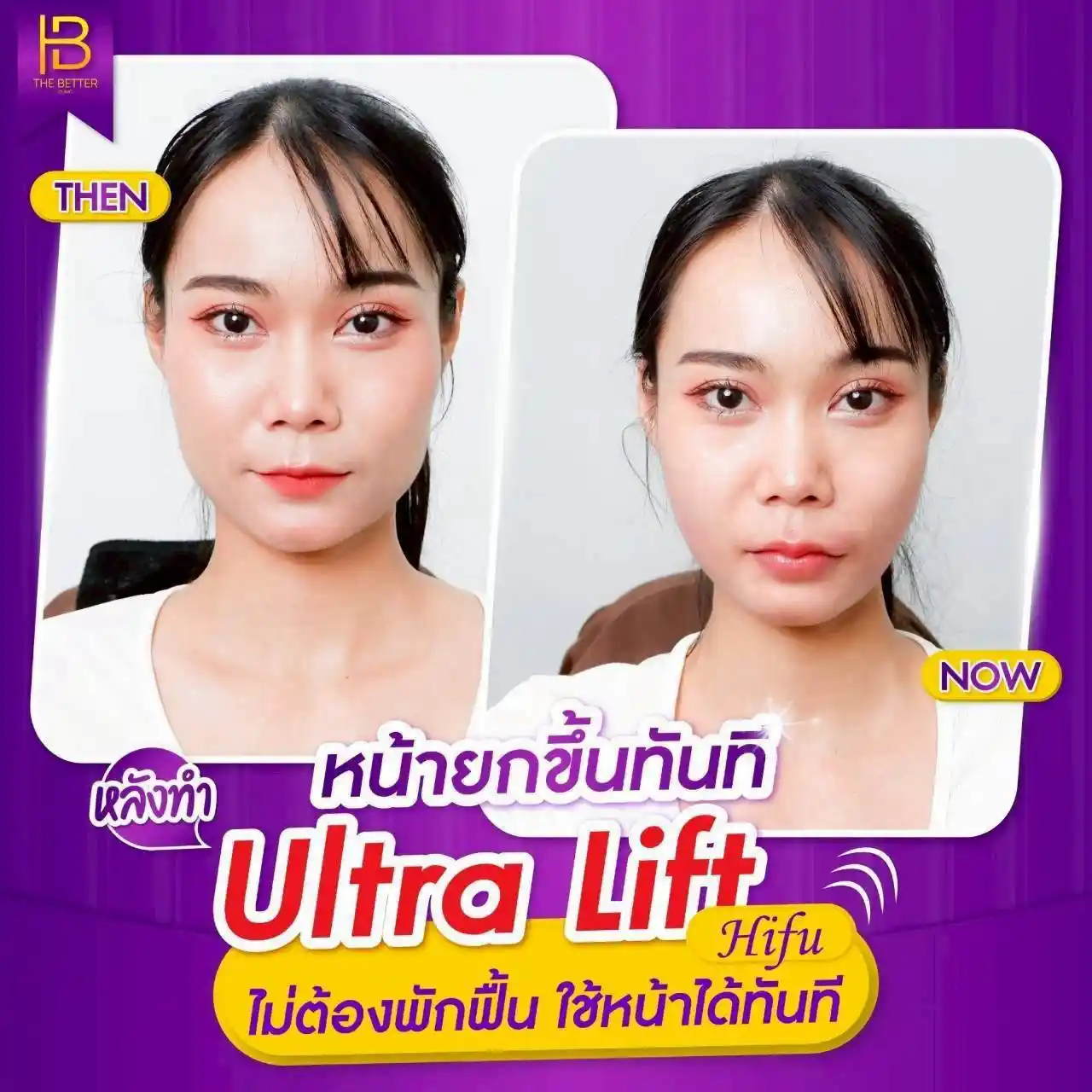 รูปรีวิว 307