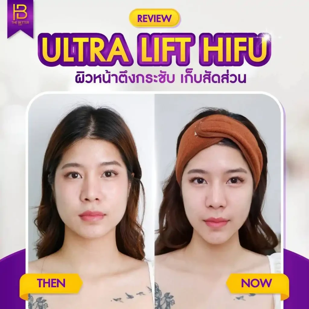 รูปรีวิว 308