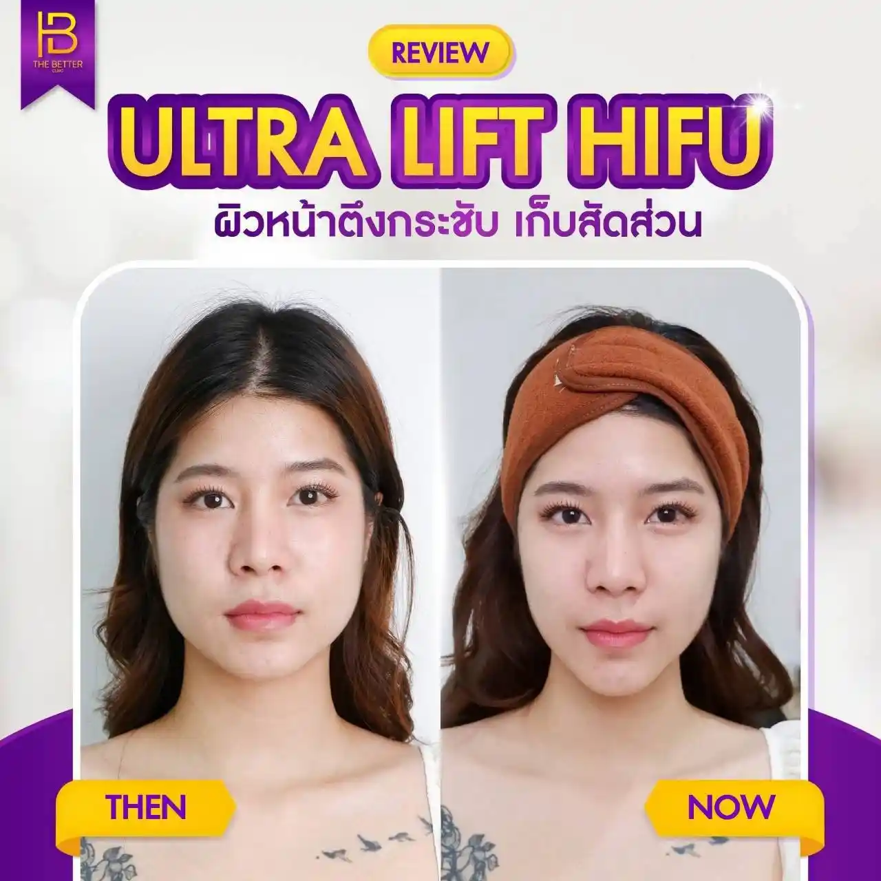 รูปรีวิว 308