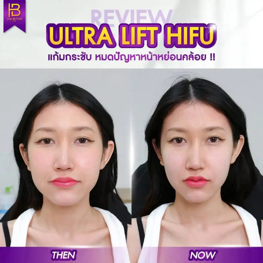 รูปรีวิว 309