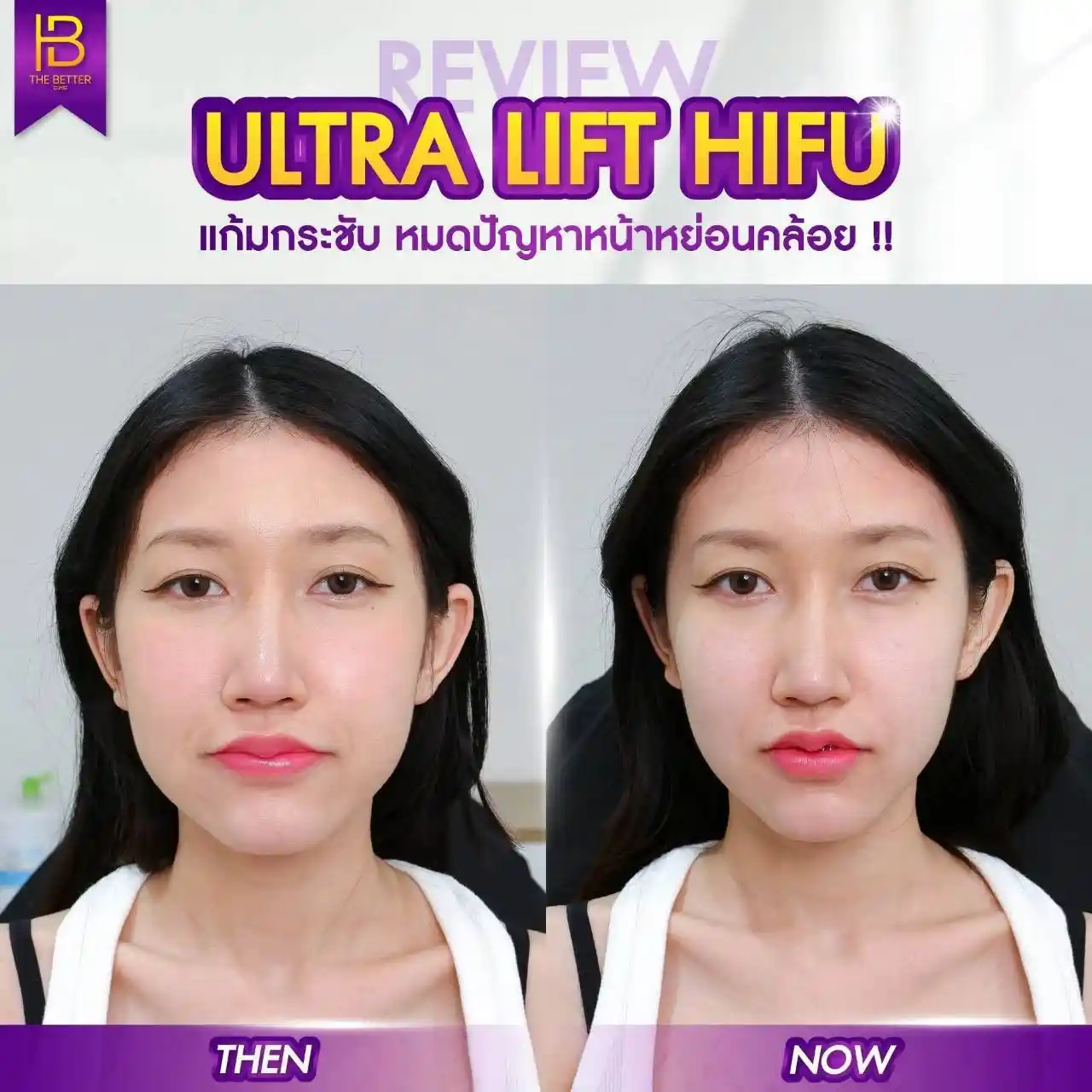 รูปรีวิว 309