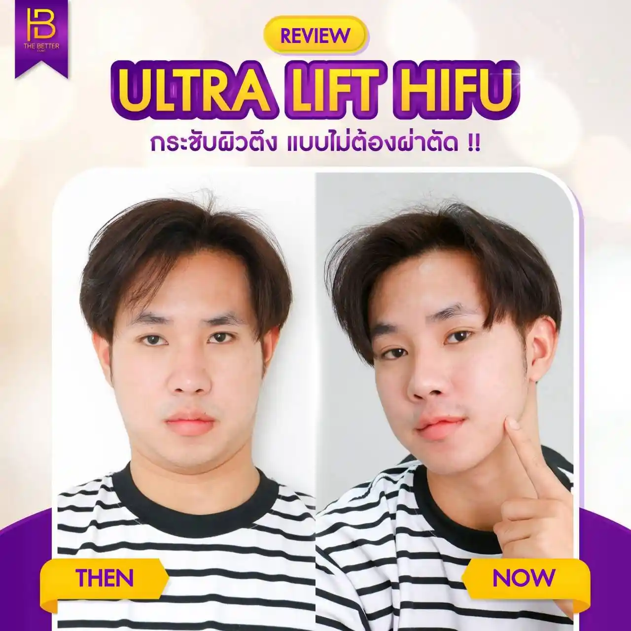 รูปรีวิว 310