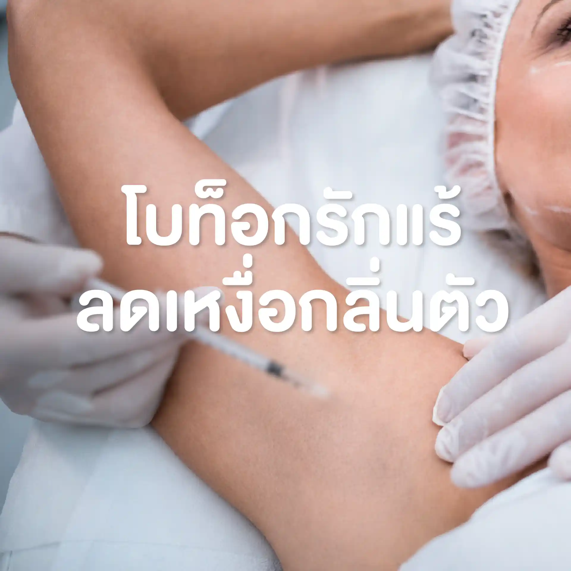 โปรแกรมโบท็อกรักแร้ลดเหงื่อกลิ่นตัว